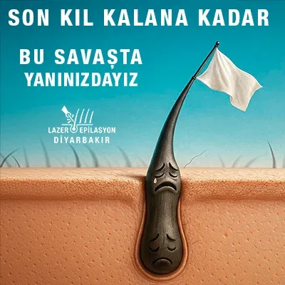 Diyarbakır lazer epilasyon 3 uygulama örneği 2