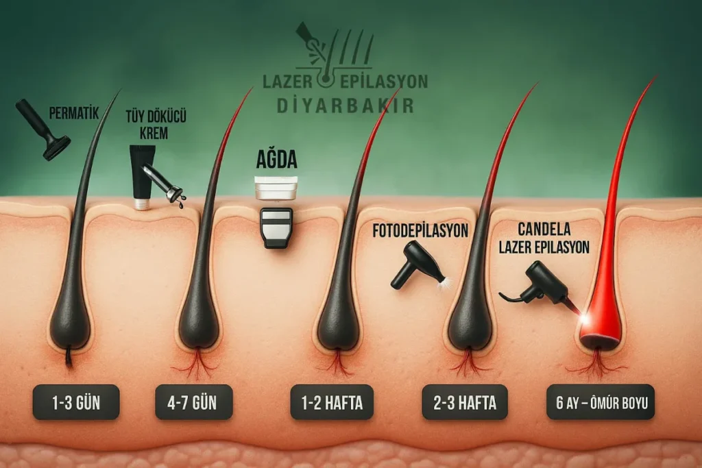 Diyarbakır lazer epilasyon uygulama örneği 5